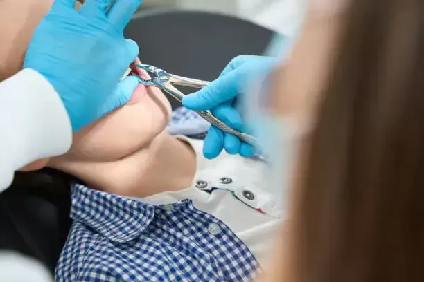 Patient undergoing a tooth extraction at Robert A. Lantzy DMD, Tooth Extractions in Newtown, PA