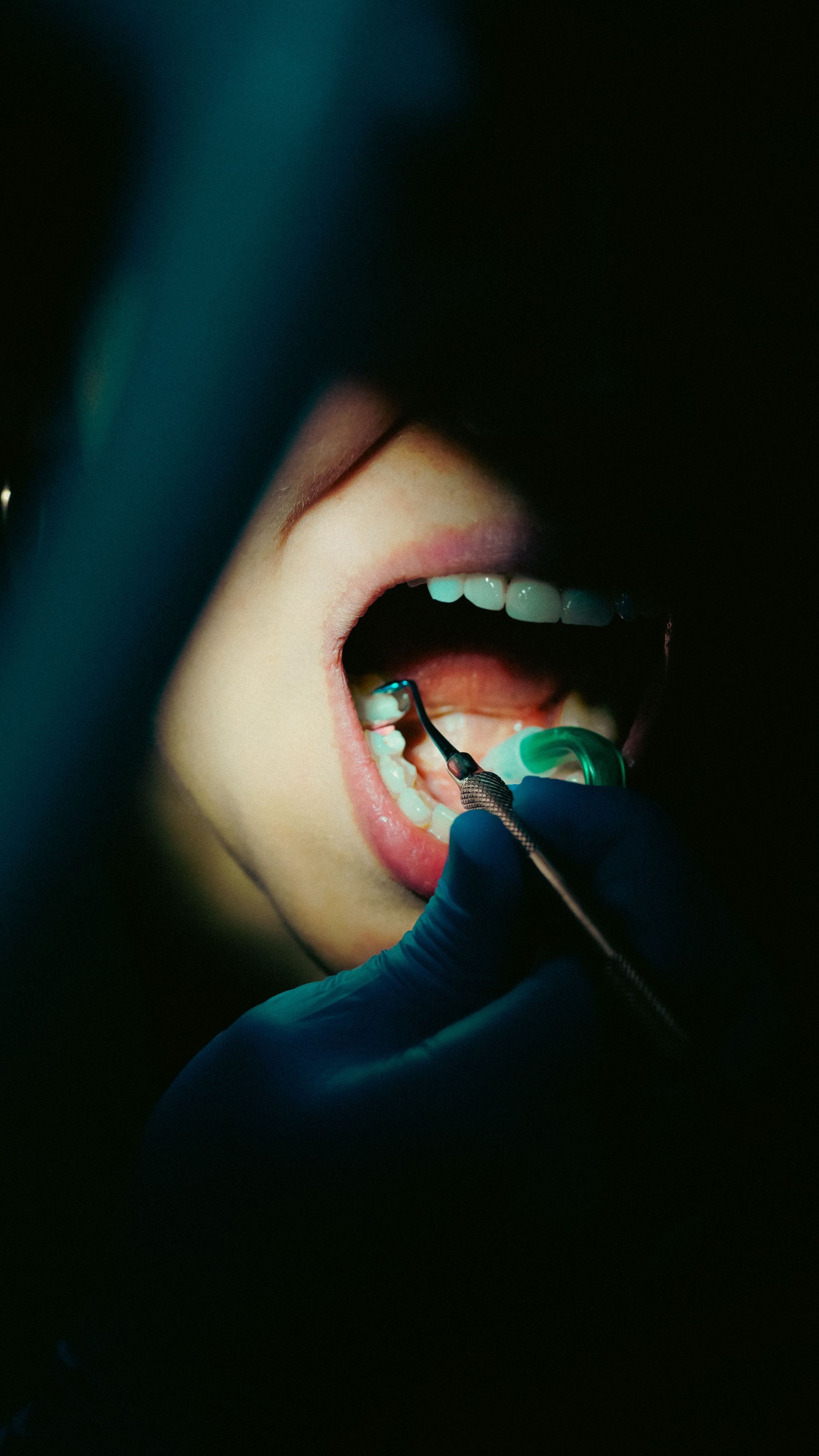 Dentist treating an infected tooth at Robert A. Lantzy DMD, Tooth Pain & Infection in Newtown, PA