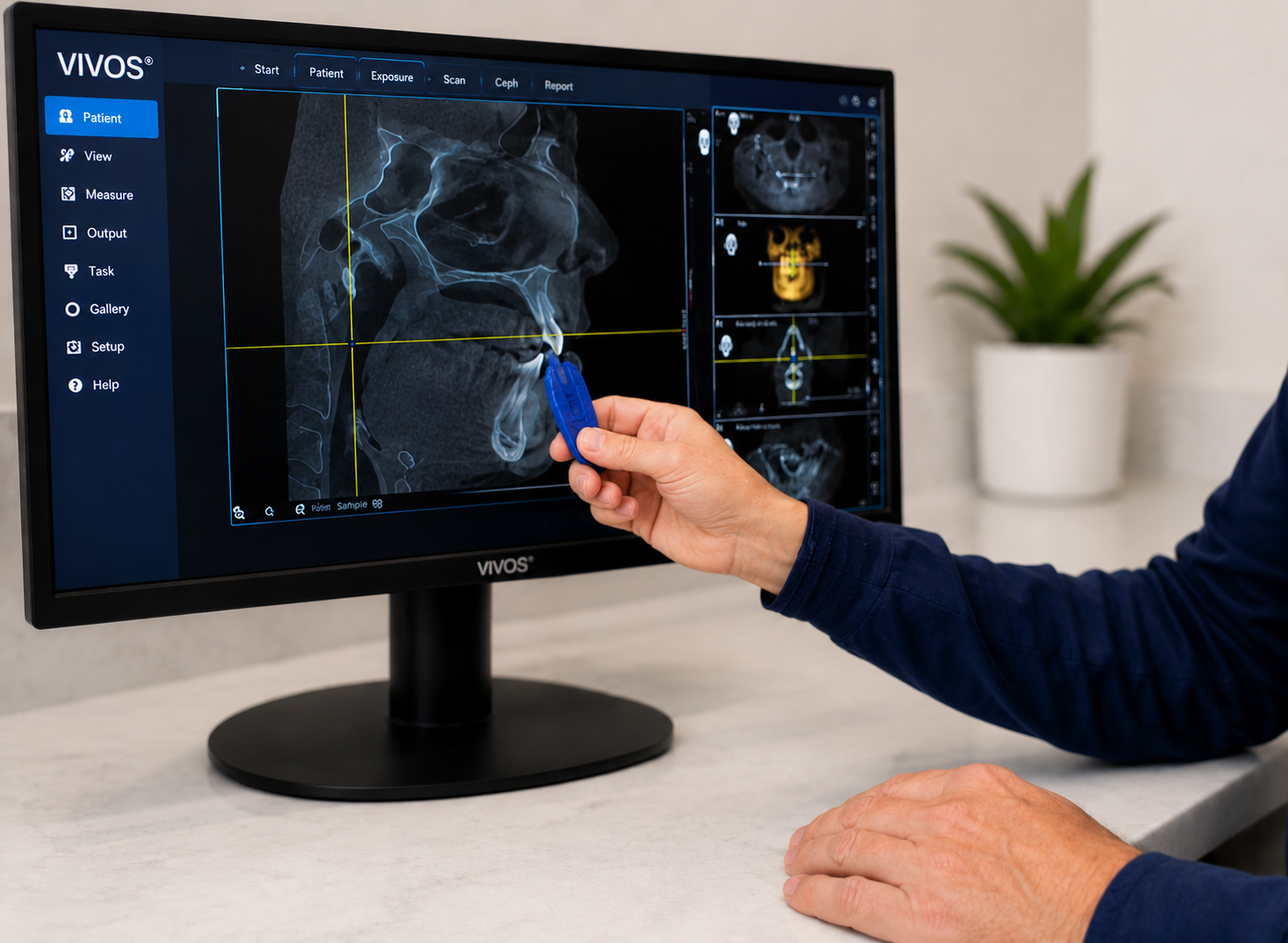Dr. Bob Lantzy reviewing Vivos Therapy imaging at Robert A. Lantzy DMD, Vivos Therapy in Newtown, PA