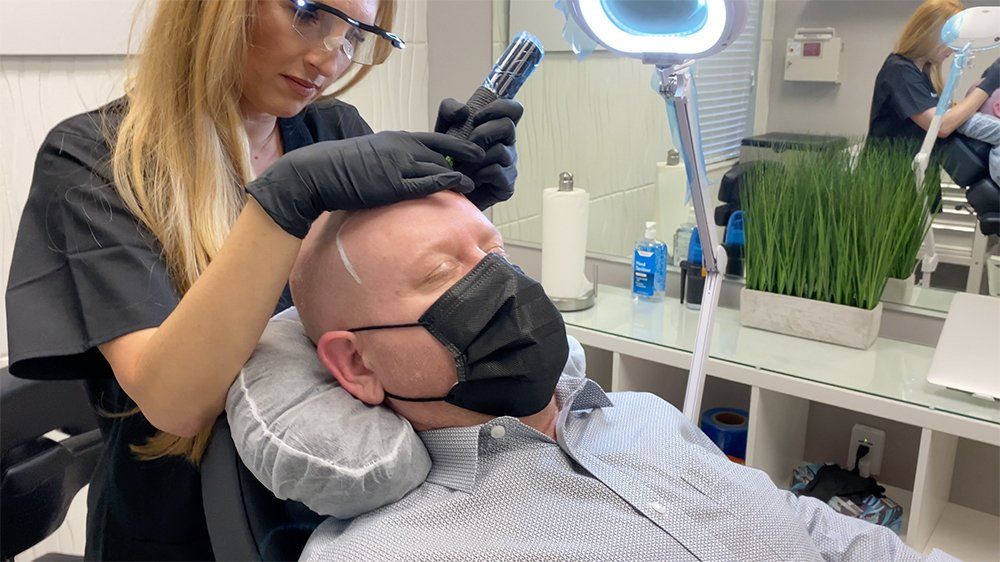 Advantages of getting a hair tattoo treatment