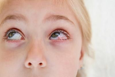 A close up of a young girl 's eyes looking up.