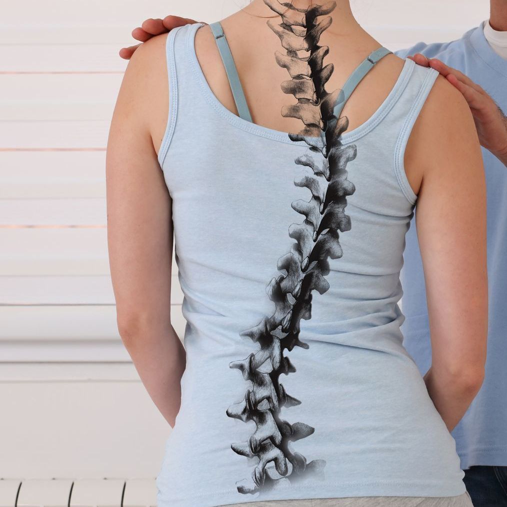 Scoliosis Therapy - Urban Spine - Vienna