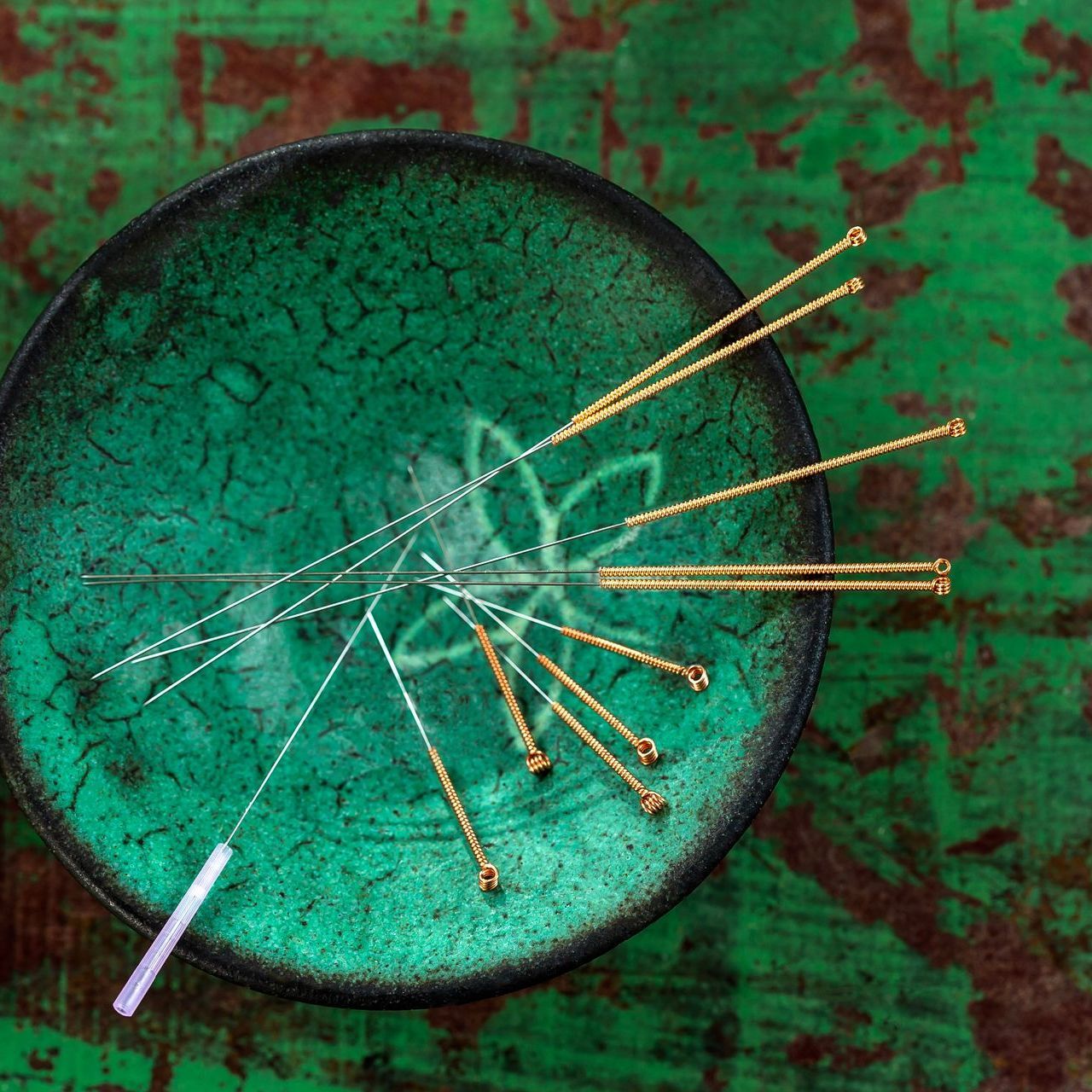 Acupuncture & TCM - Urban Spine