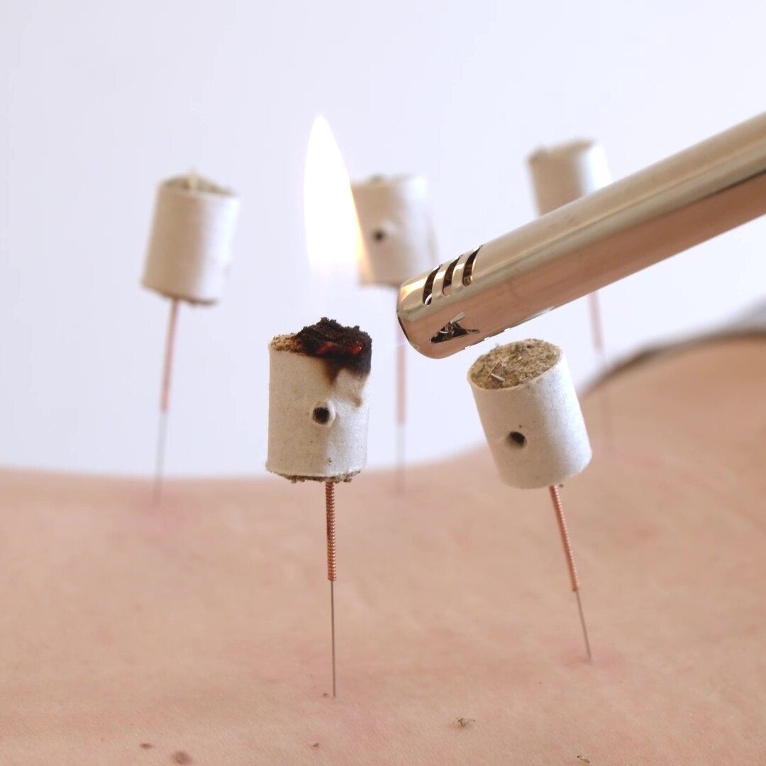 Moxibustion Moxibustion, Akupunktur & TCM - Urban Spine - 1010 Wien