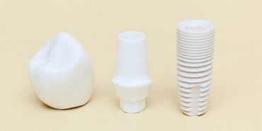 Was sind Zahnimplantate und woraus bestehen sie? Wie werden Implantate gesetzt? Was sind Zahnimplantate und woraus bestehen sie? Wie werden Implantate gesetzt?