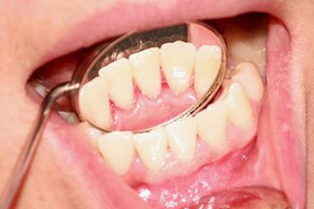 Periodontologija Periodontologija