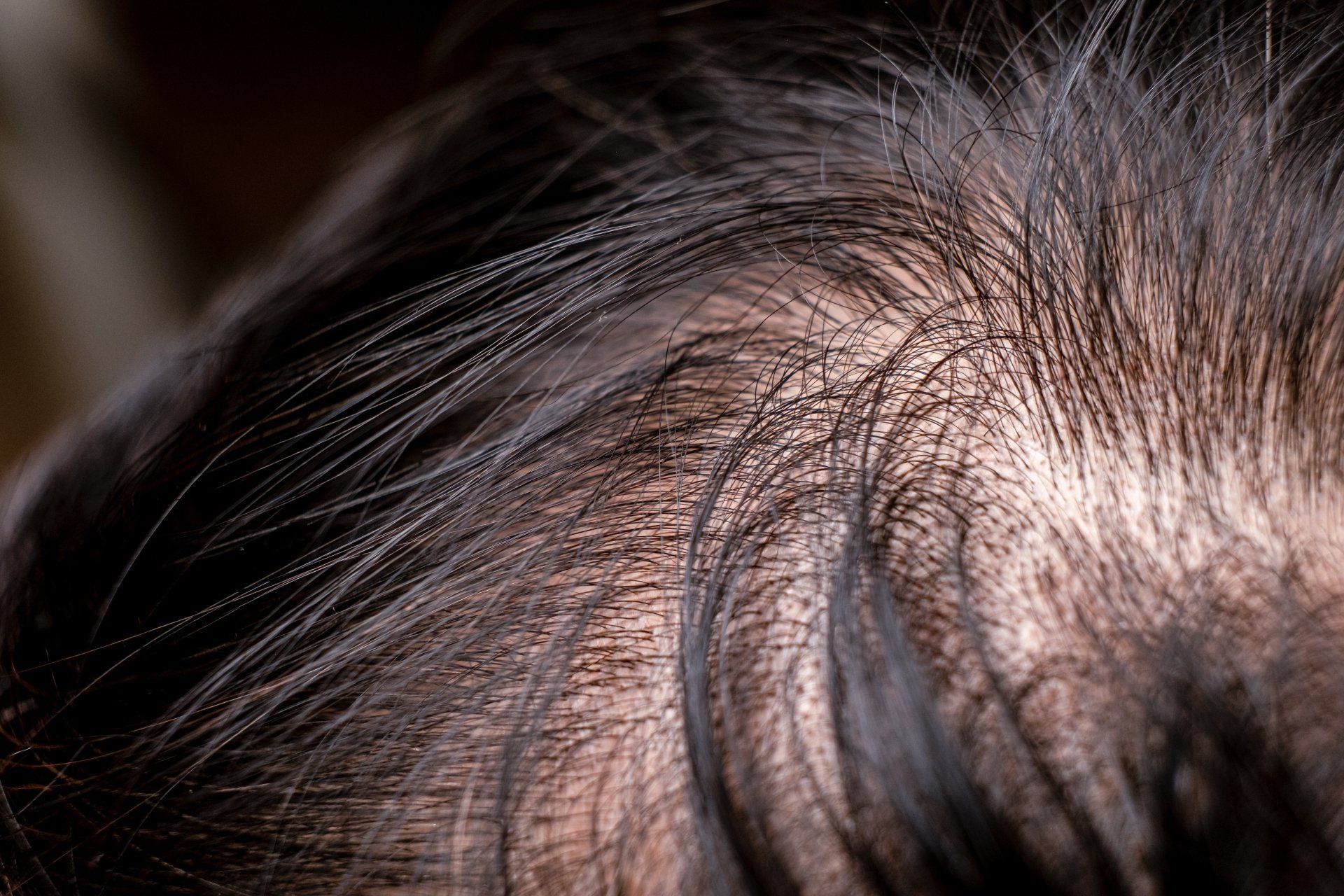 Hair loss and thinning hair