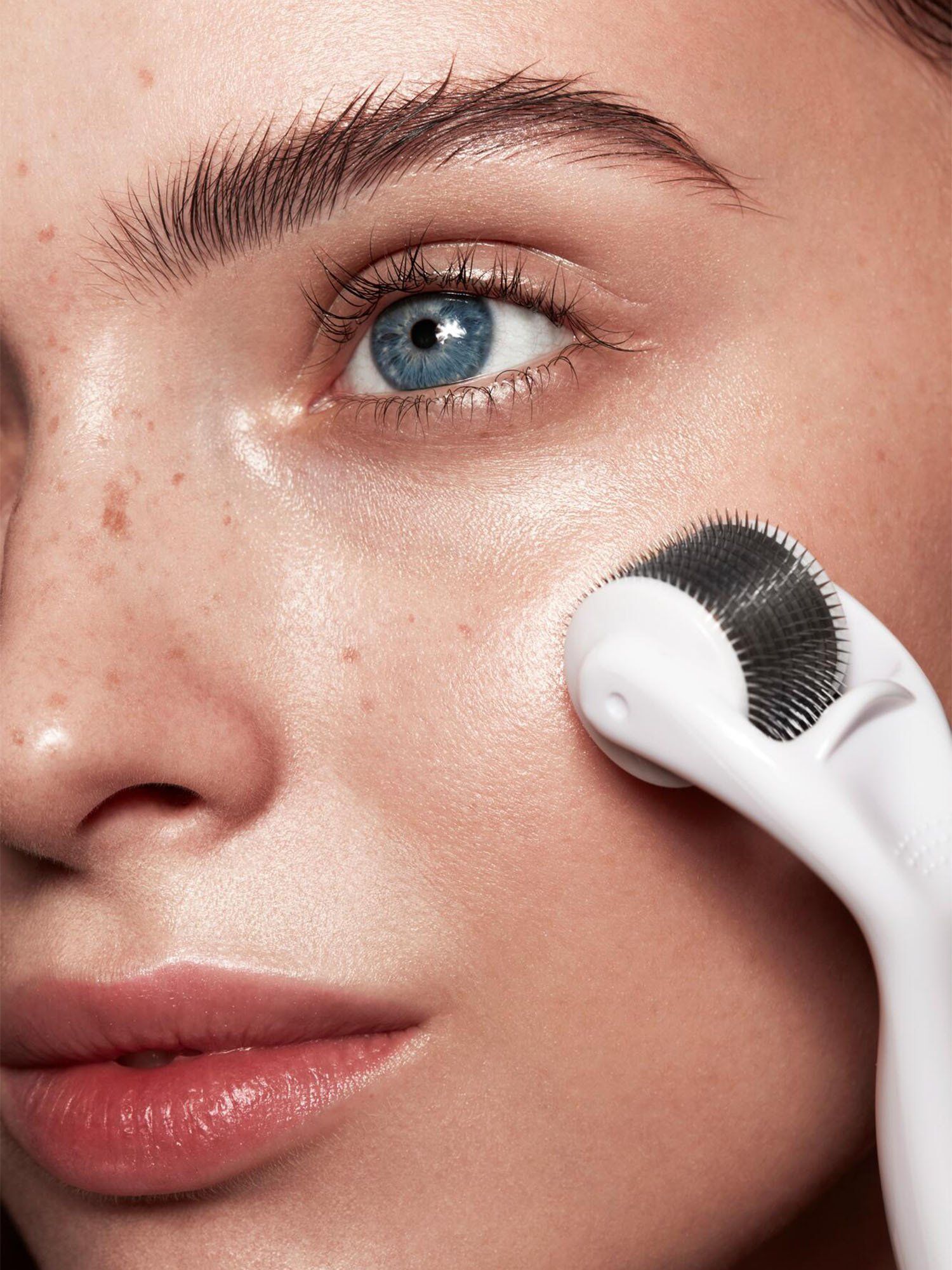 Microneedling treatment on face