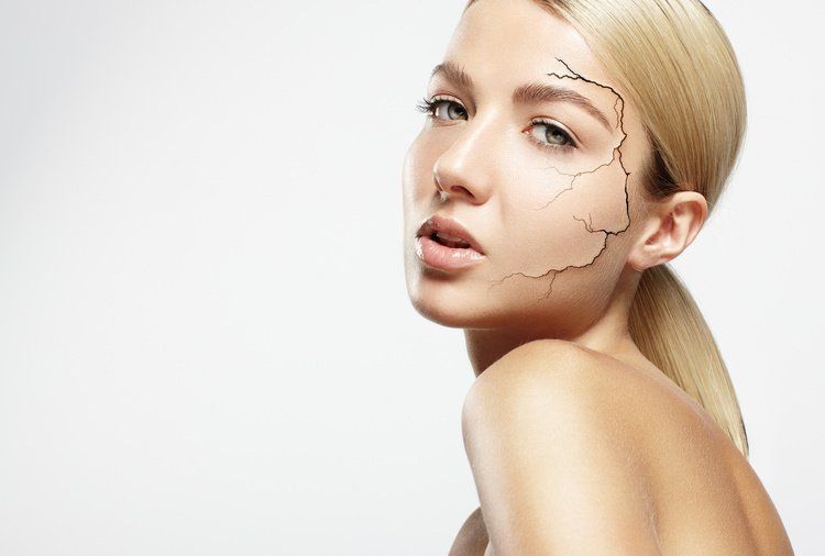An image displaying a play on the words chemical peel