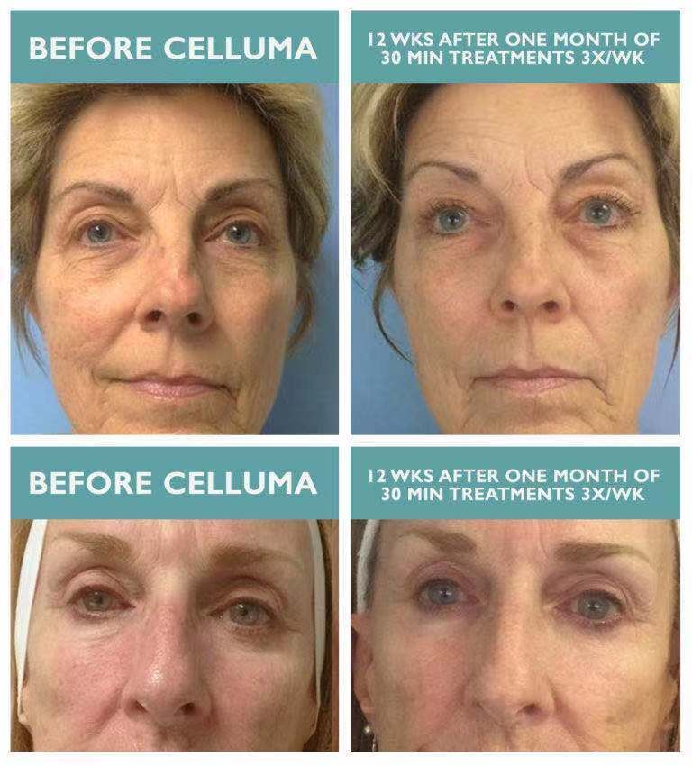 A before and after photo of a woman 's face