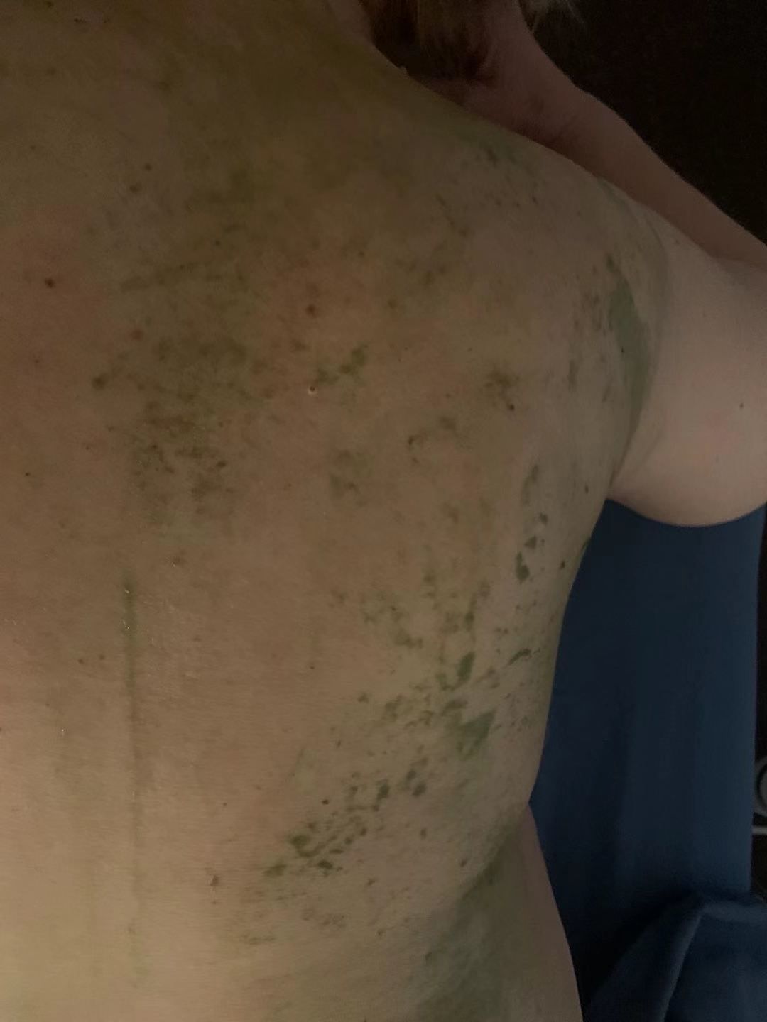 A close up of a person 's back with green spots on it.