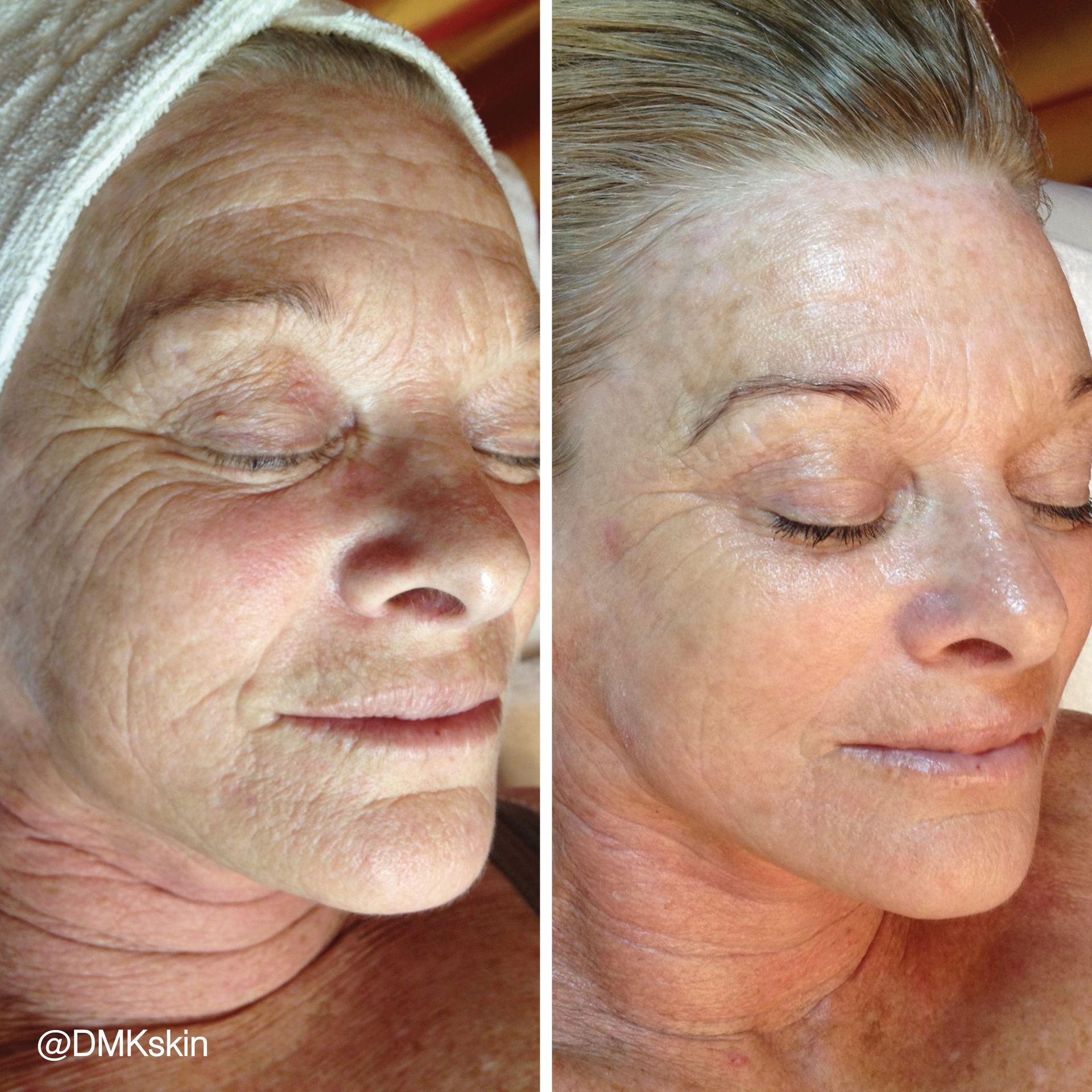A before and after photo of a woman 's face.