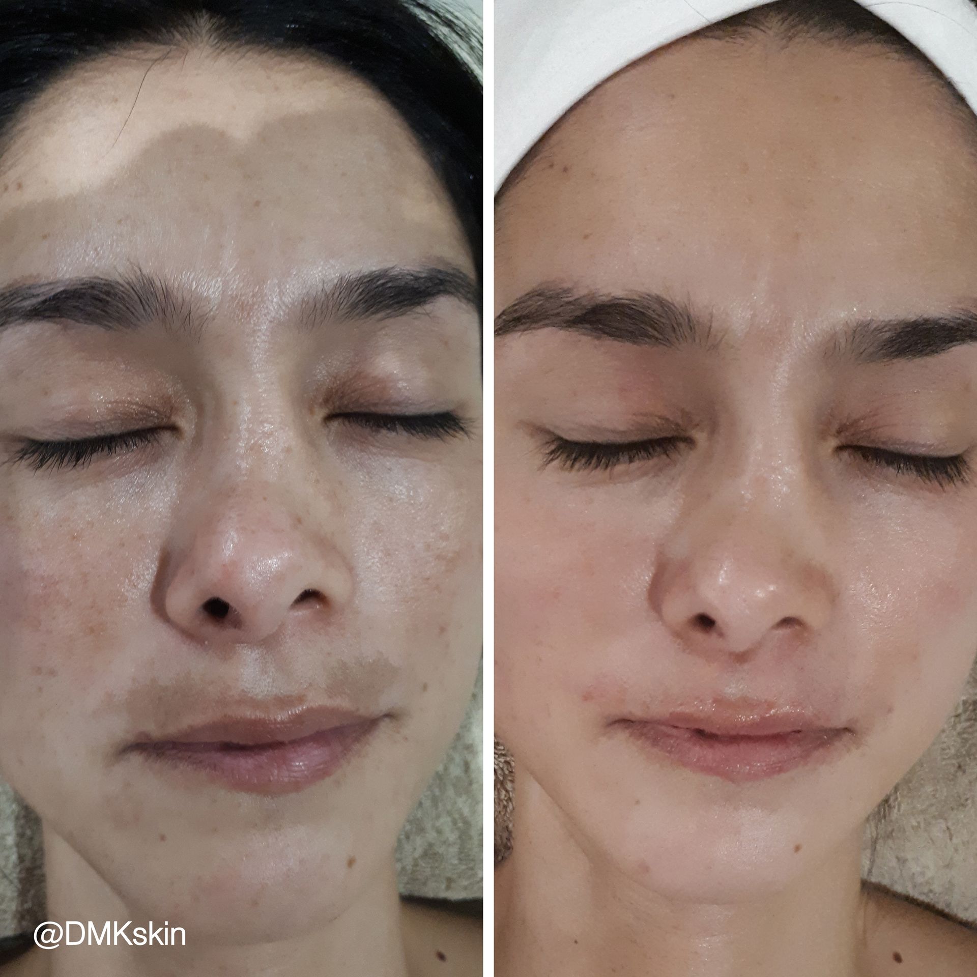 A before and after photo of a woman 's face with her eyes closed.