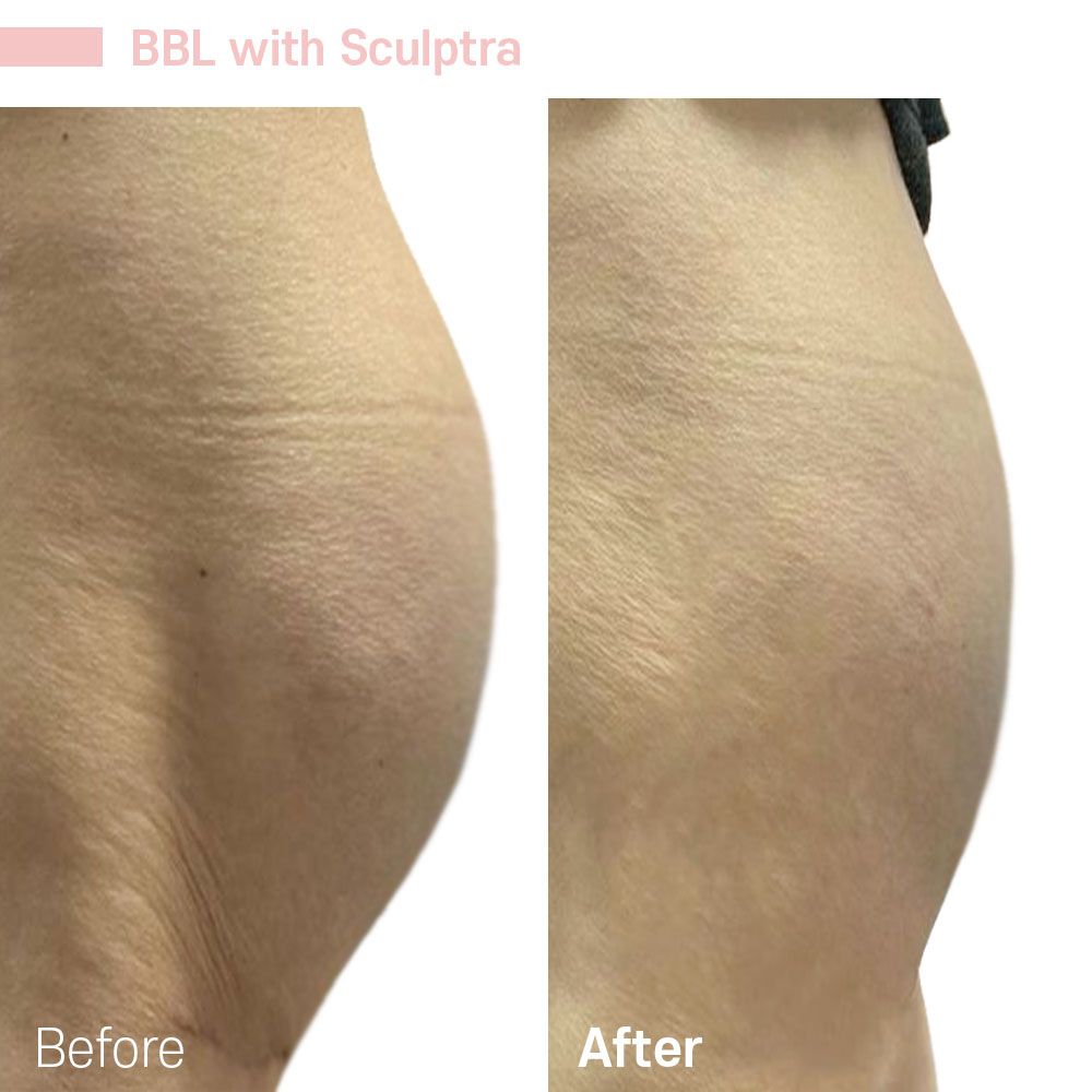 Before And After Fifty — Tustin, CA — RoseK Medical