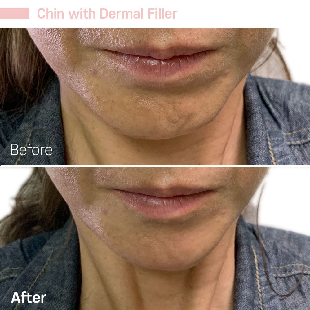 Before And After Forty Five — Tustin, CA — RoseK Medical