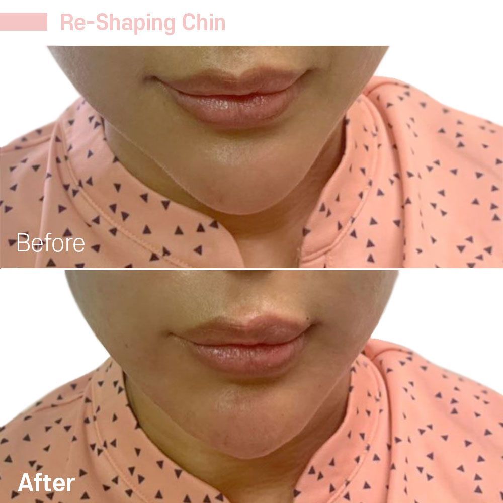 Before And After Forty Eigth — Tustin, CA — RoseK Medical