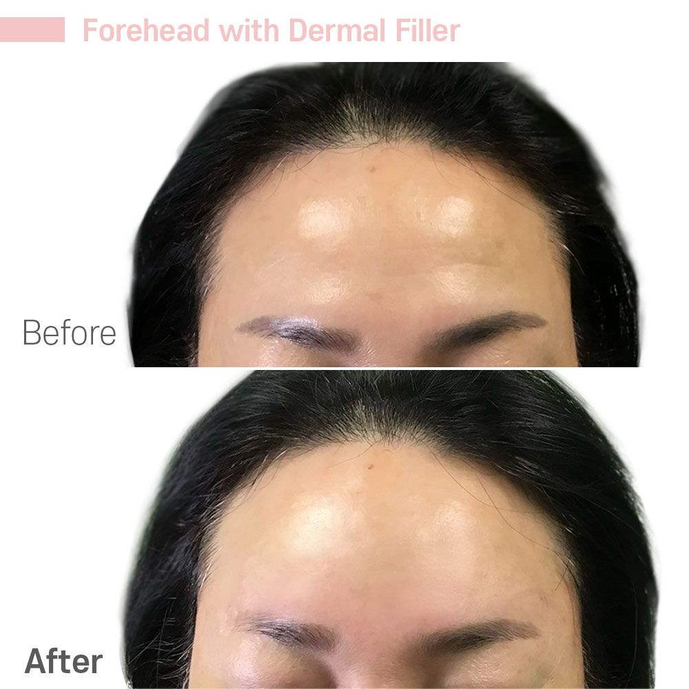 Before And After Forty Three — Tustin, CA — RoseK Medical