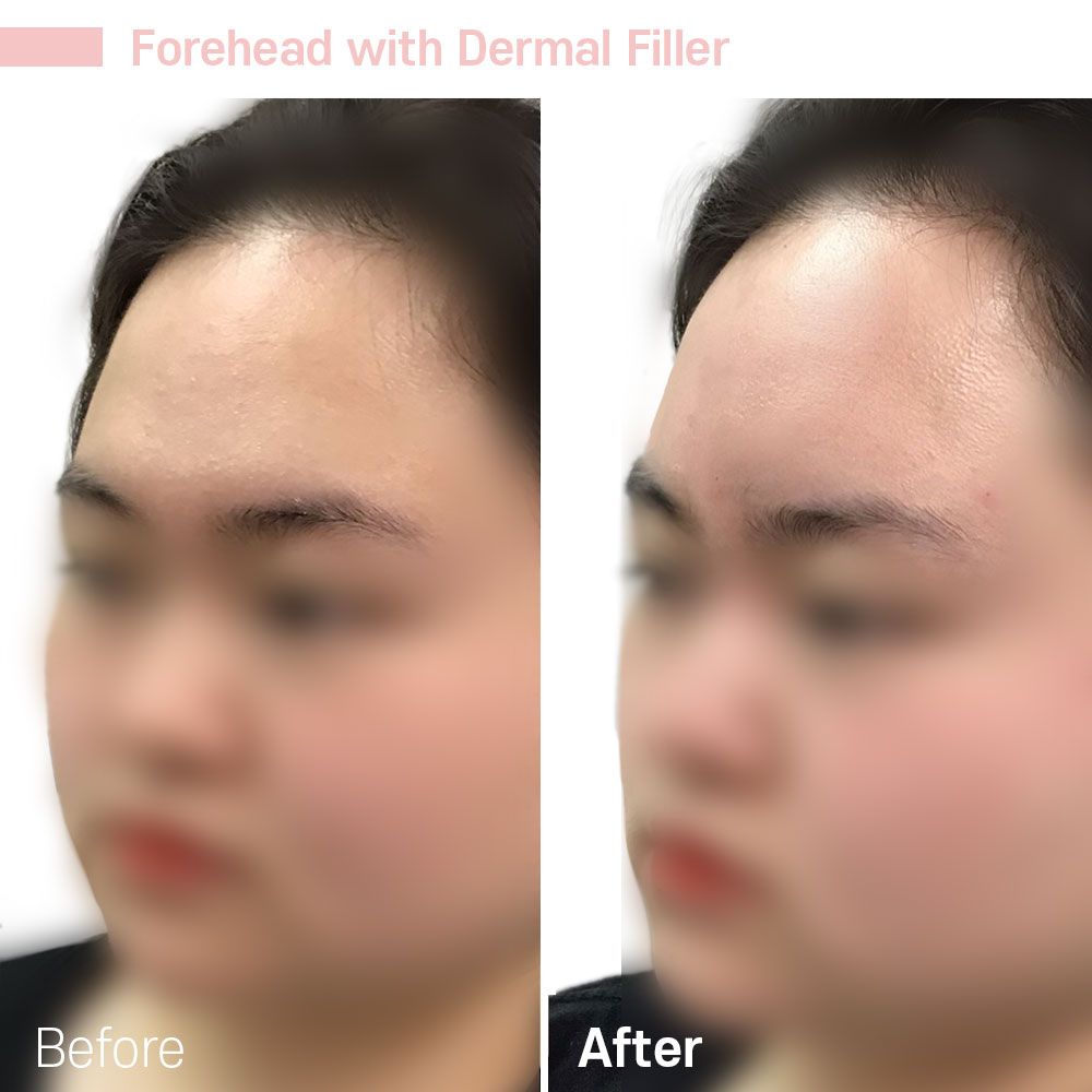 Before And After Forty Two — Tustin, CA — RoseK Medical
