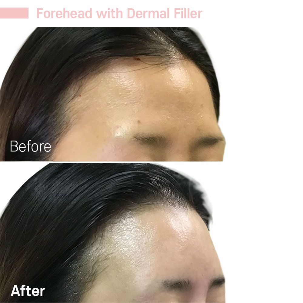 Before And After Forty One — Tustin, CA — RoseK Medical