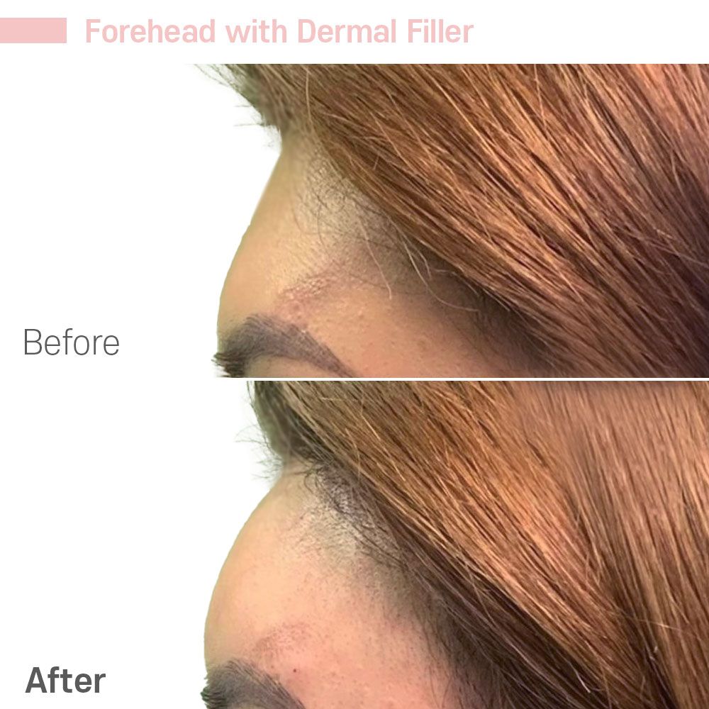 Before And After Thirty Eight — Tustin, CA — RoseK Medical