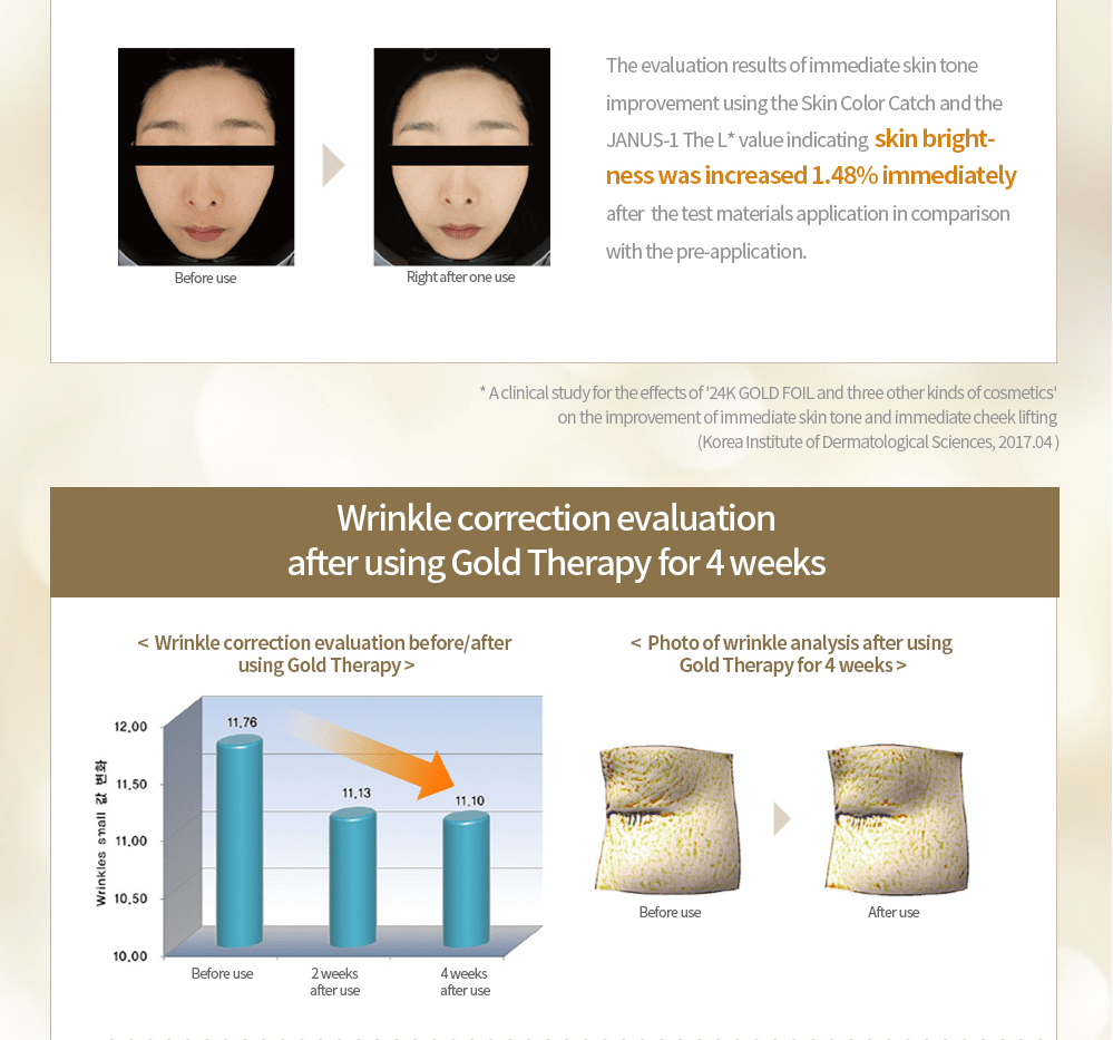 Gold Therapy Wrinkle Correction Evaluation — Tustin, CA — RoseK Medical