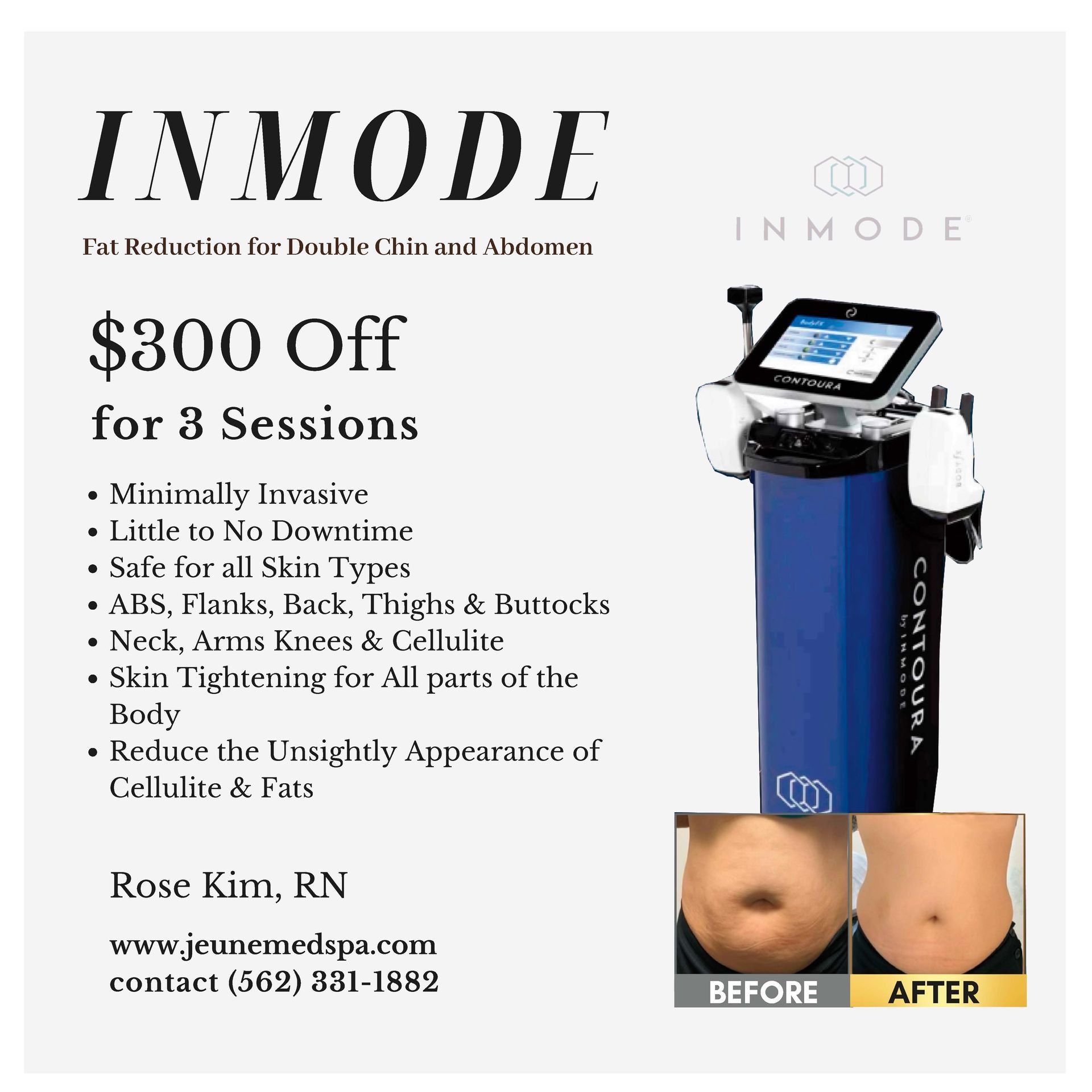 Promotions Five — Tustin, CA — RoseK Medical