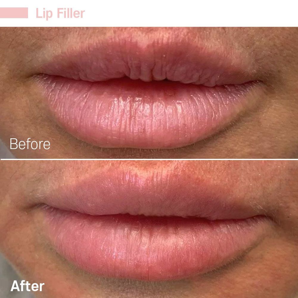 Before And After Nineteen — Tustin, CA — RoseK Medical