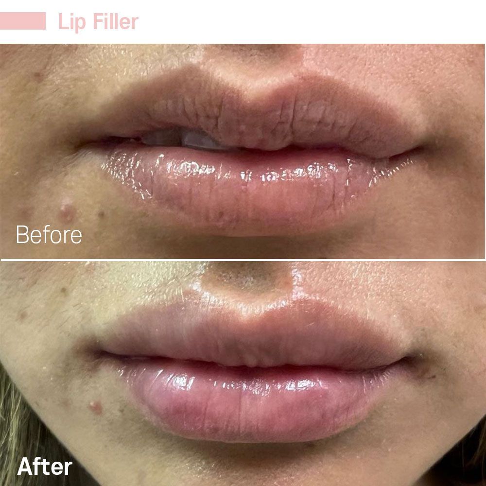 Before And After Eighteen — Tustin, CA — RoseK Medical