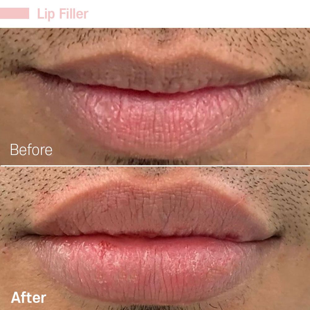 Before And After Twenty One — Tustin, CA — RoseK Medical
