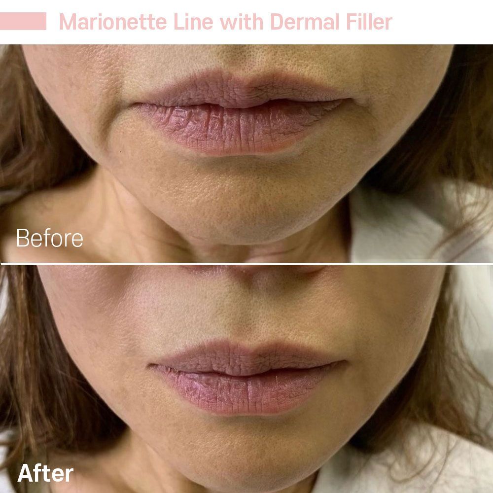 Before And After Fifteen — Tustin, CA — RoseK Medical