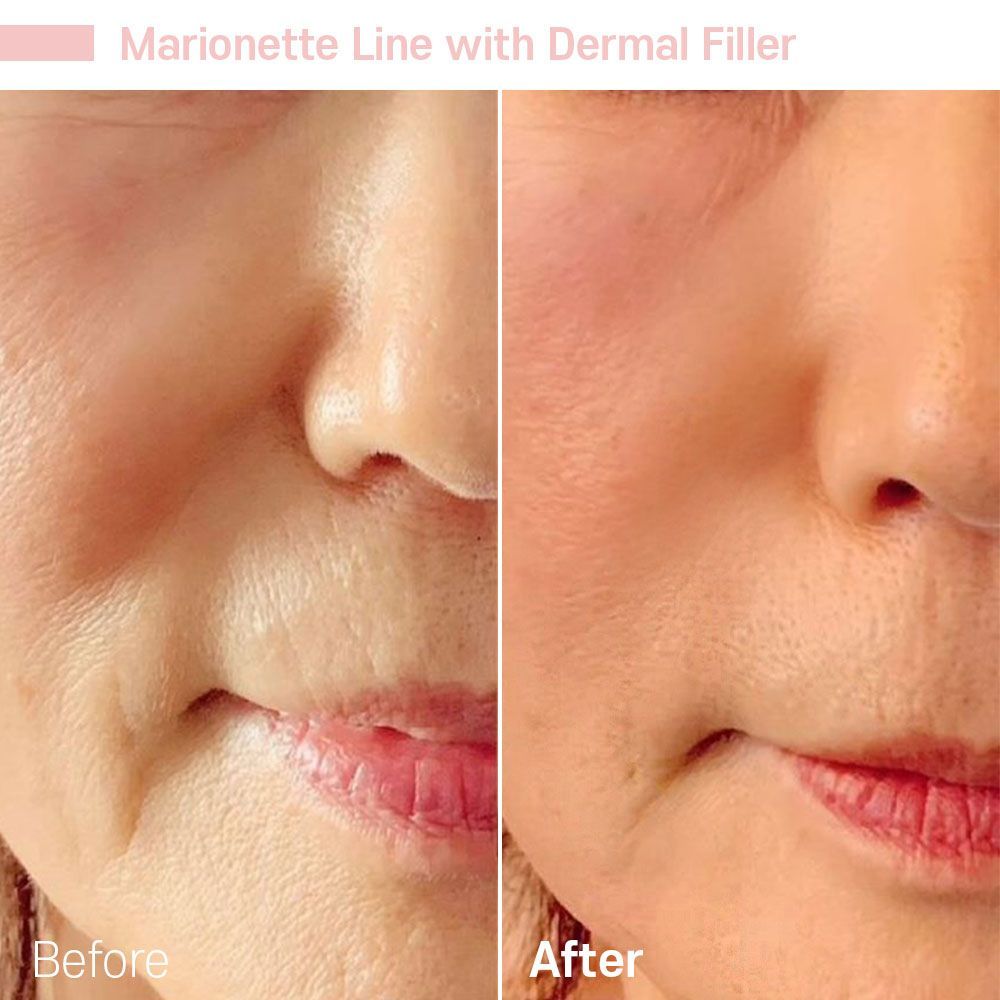 Before And After Sixteen — Tustin, CA — RoseK Medical