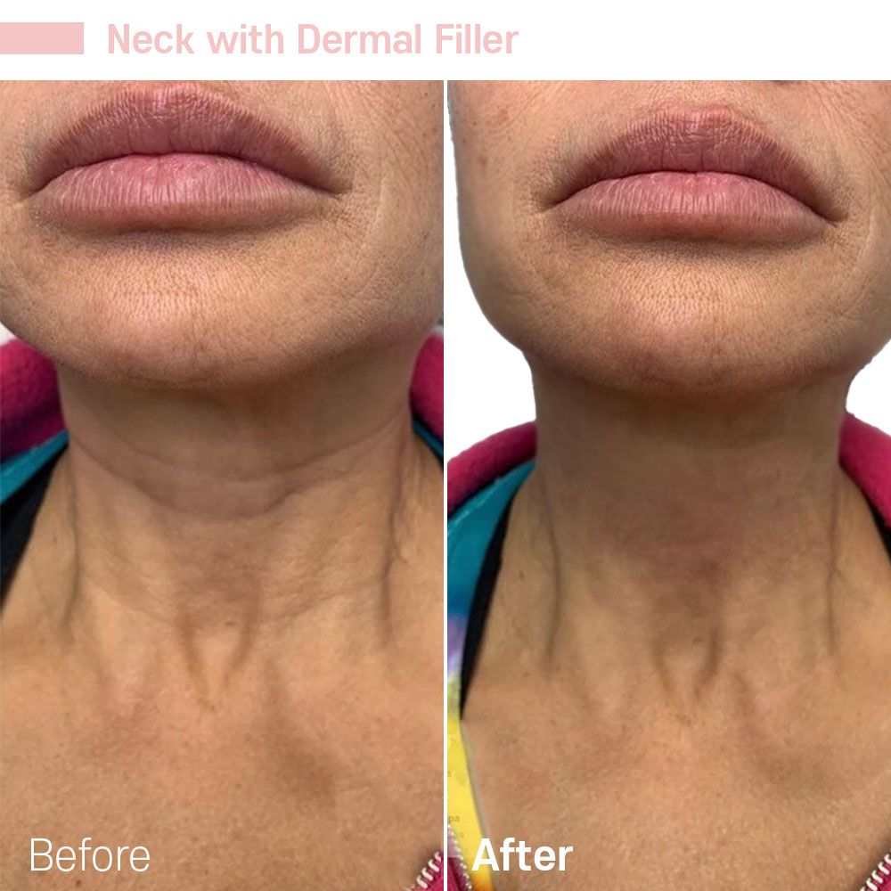 Before And After Fourteen — Tustin, CA — RoseK Medical