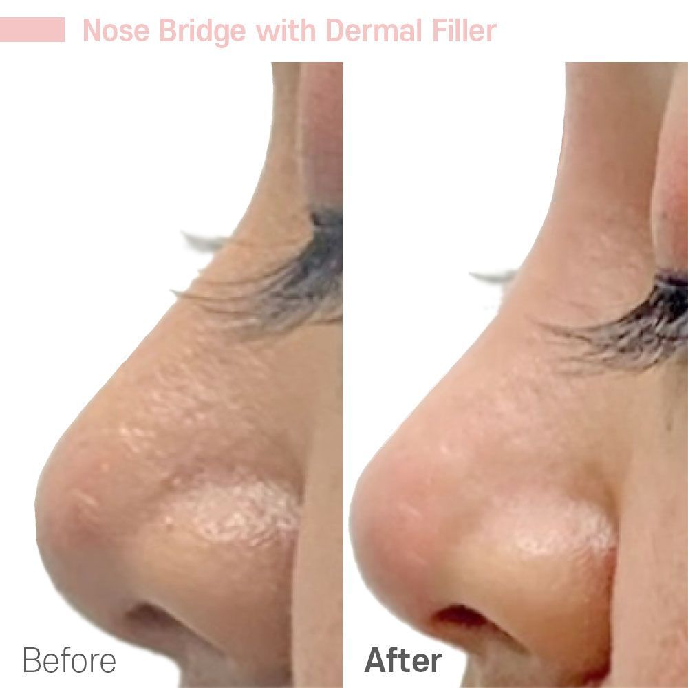 Before And After Twelve — Tustin, CA — RoseK Medical
