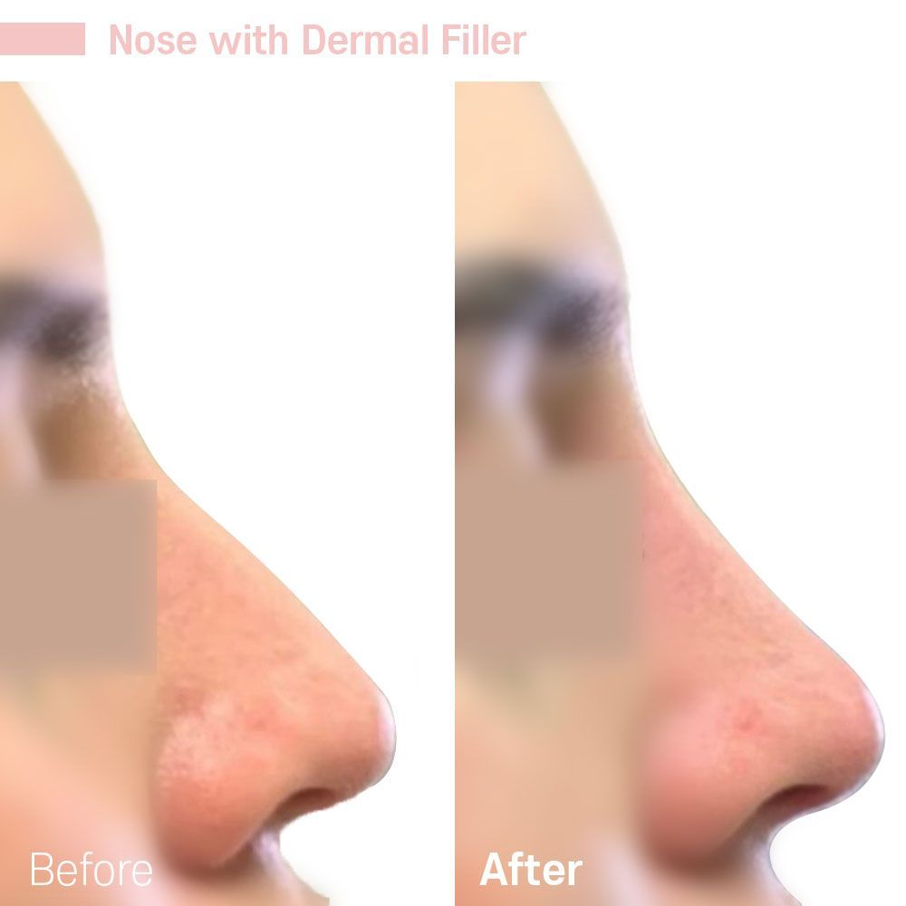 Before And After Thirteen — Tustin, CA — RoseK Medical