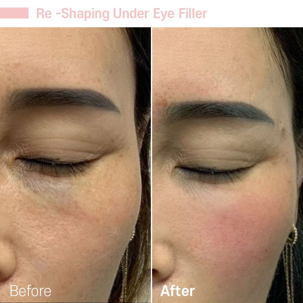 Before And After Four — Tustin, CA — RoseK Medical