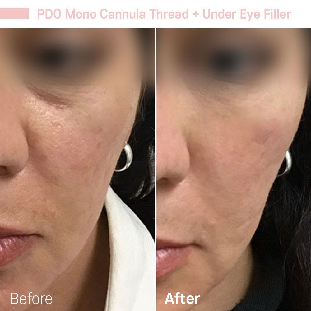 Before And After Three — Tustin, CA — RoseK Medical