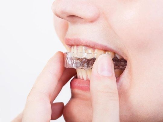 trattamenti dentali
