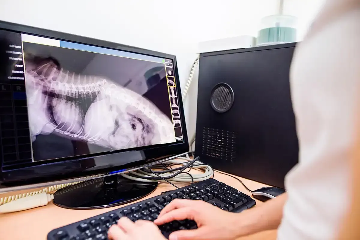Person reviewing a digital X-ray on a desktop computer in a clinic office