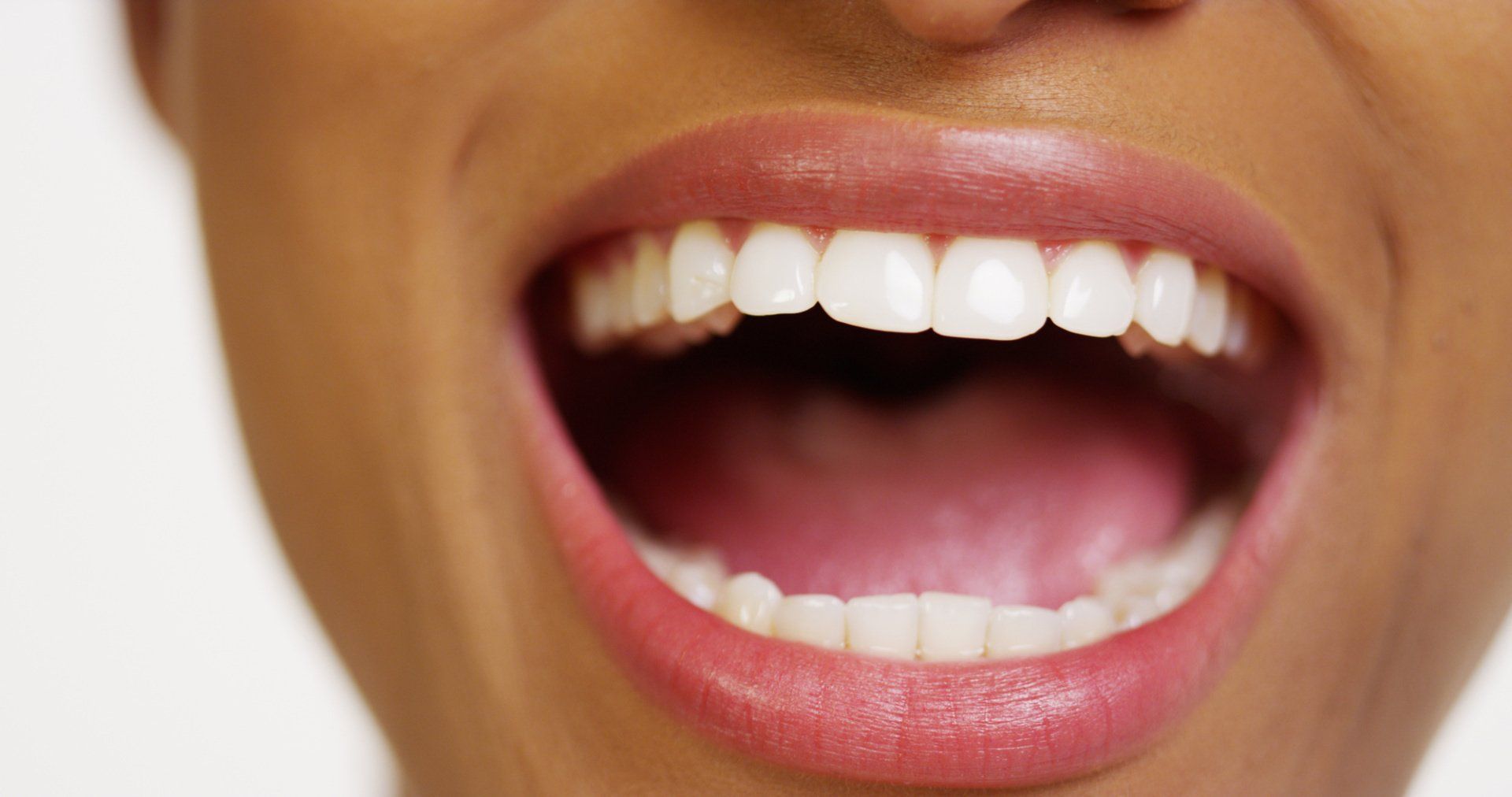Full Mouth Rehabilitation