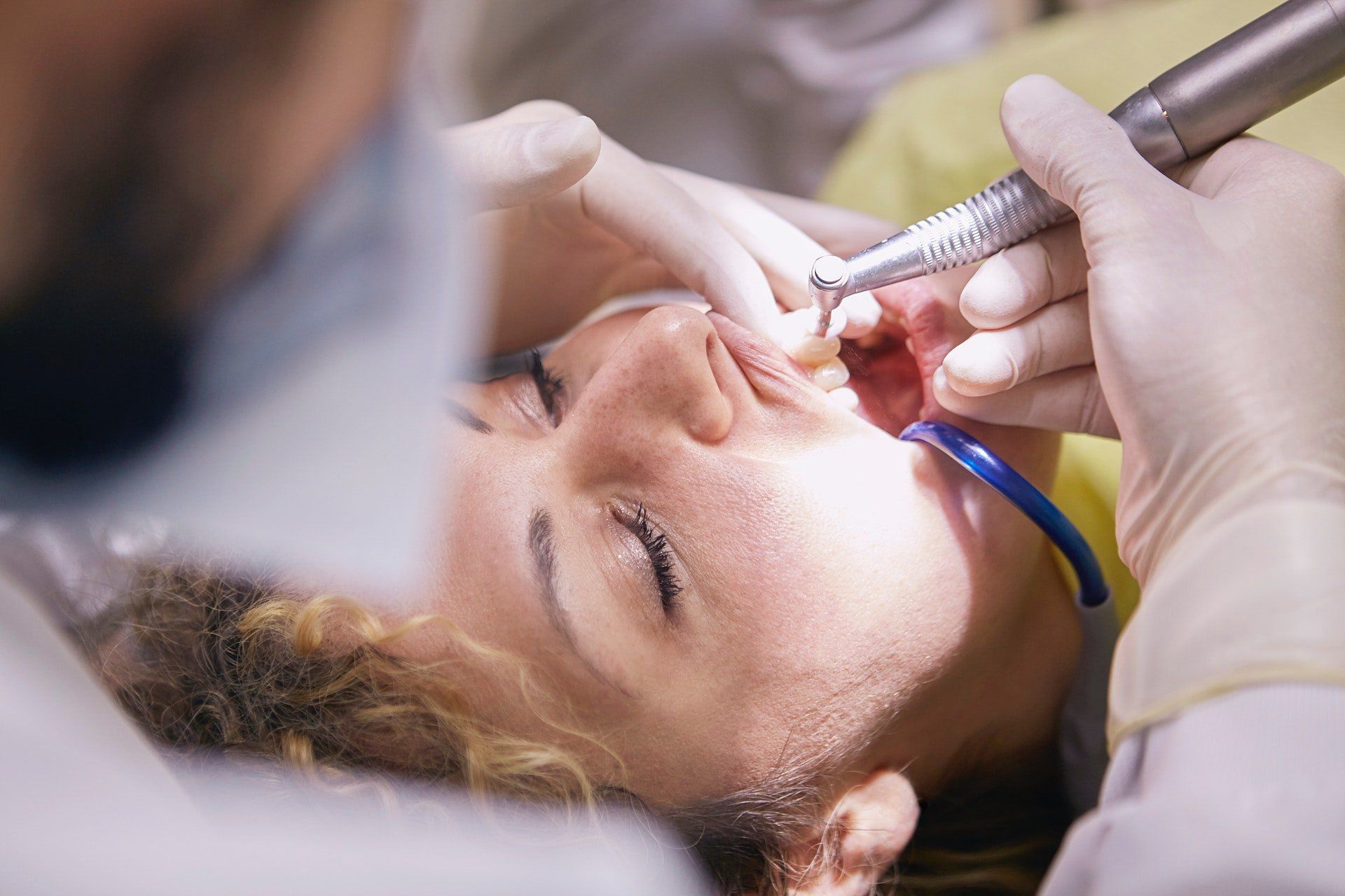 dental emergency, broken tooth