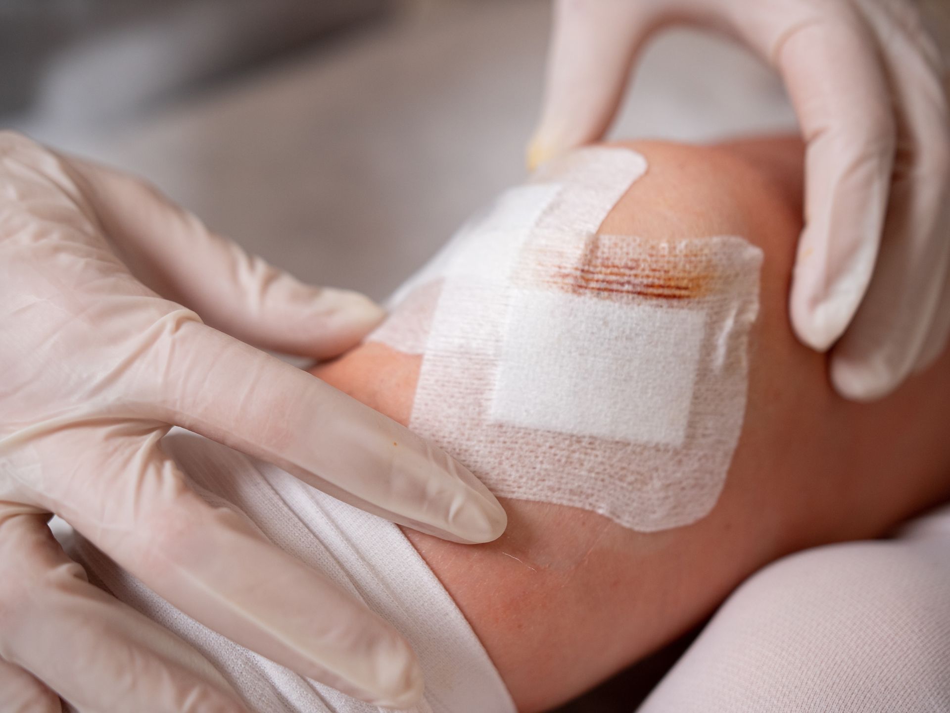 A person is getting a bandage on their arm