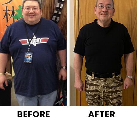 Side-by-side before-and-after photos of a man showing significant weight loss, labeled 