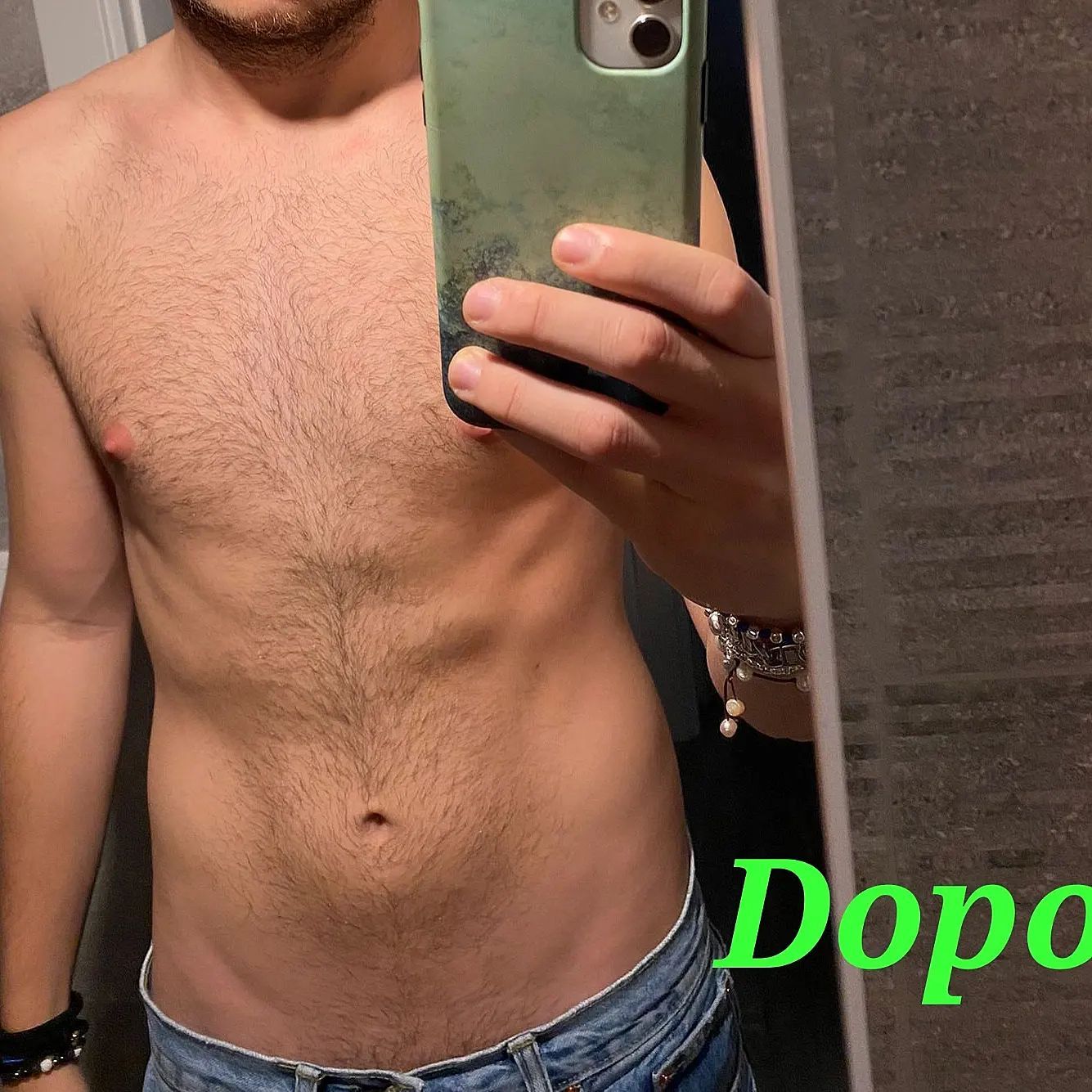 prima e dopo calo del peso