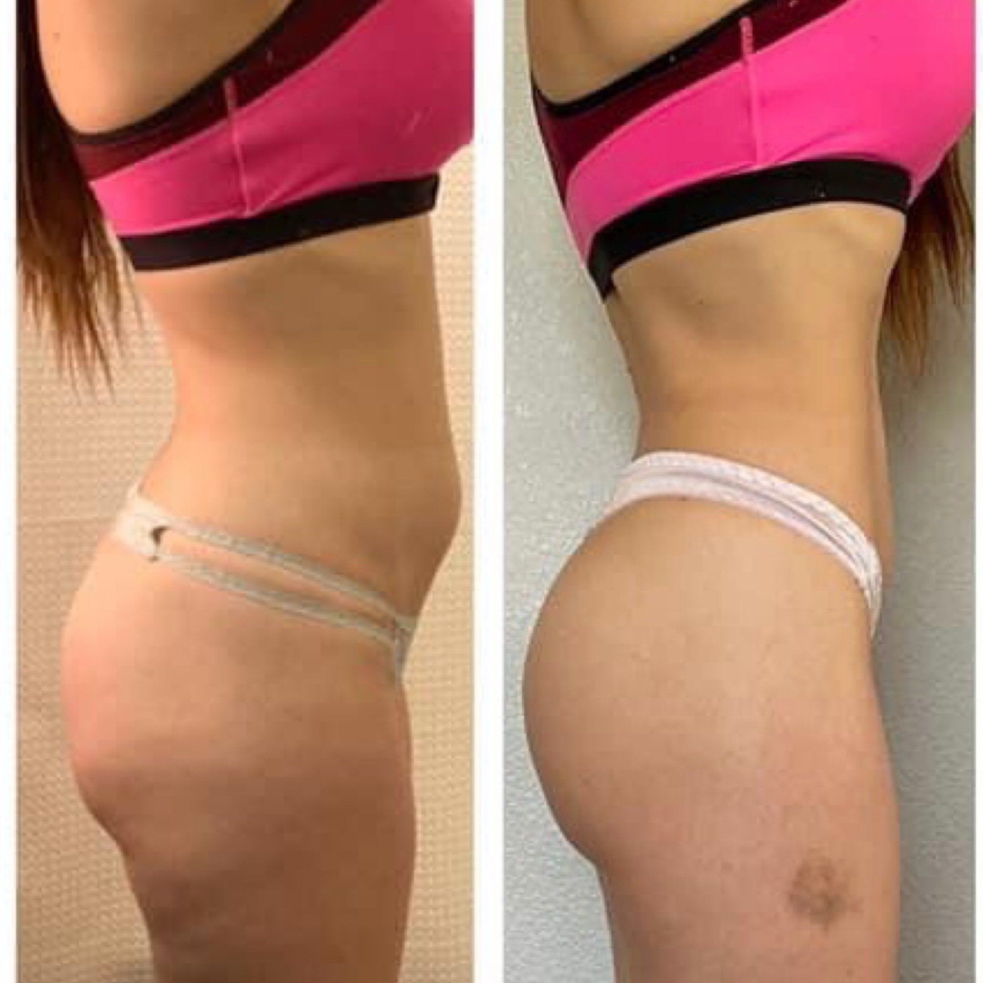 Michie client transformation
