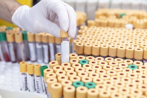 provette per analisi cliniche