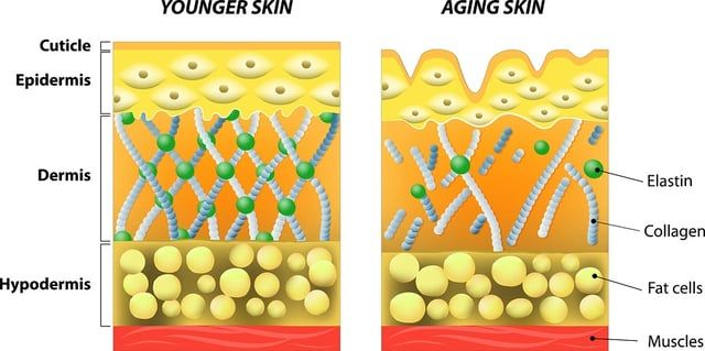 Diagram comparing younger and aging skin layers, showing differences in collagen, elastin, and fat cells.