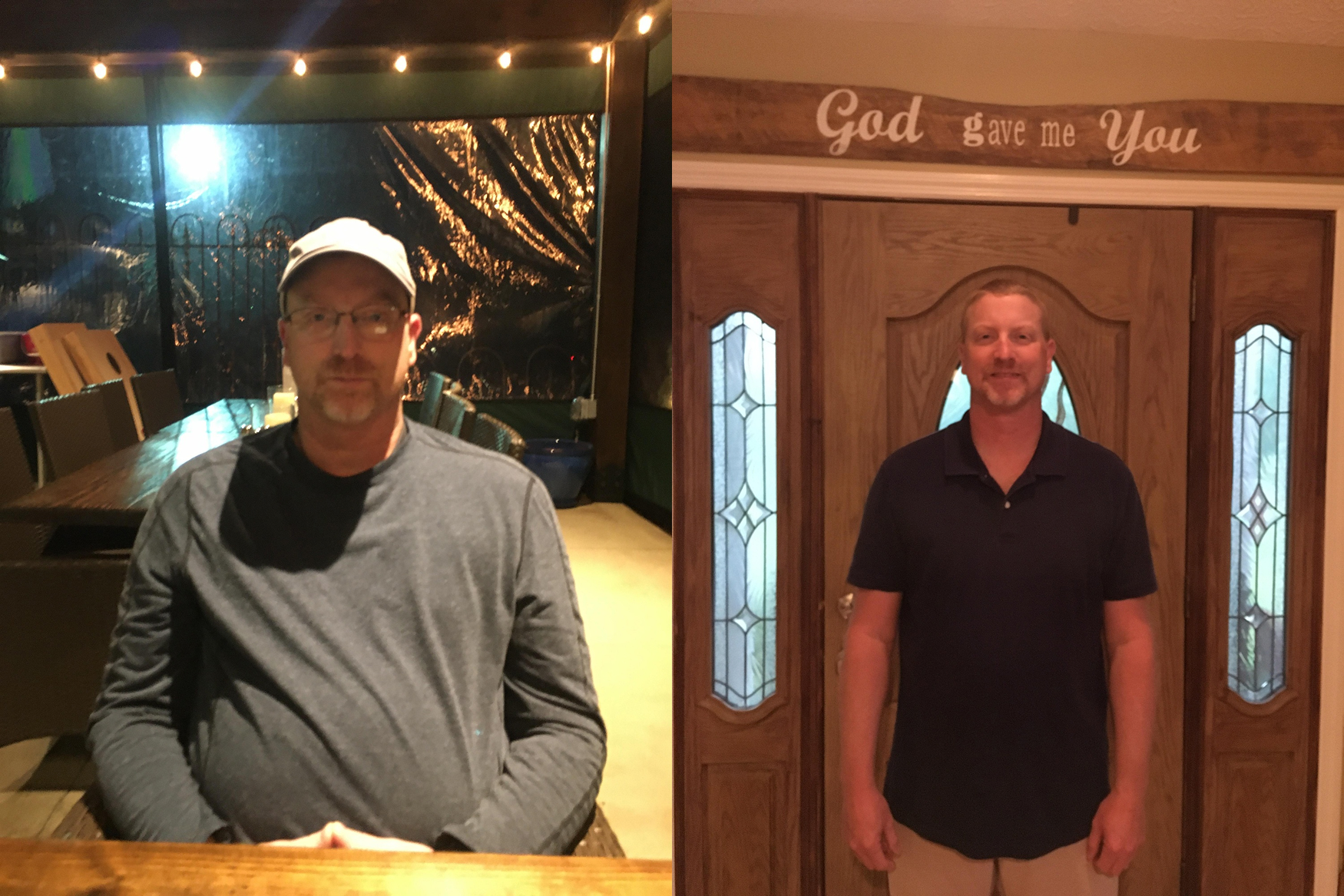 before and after
