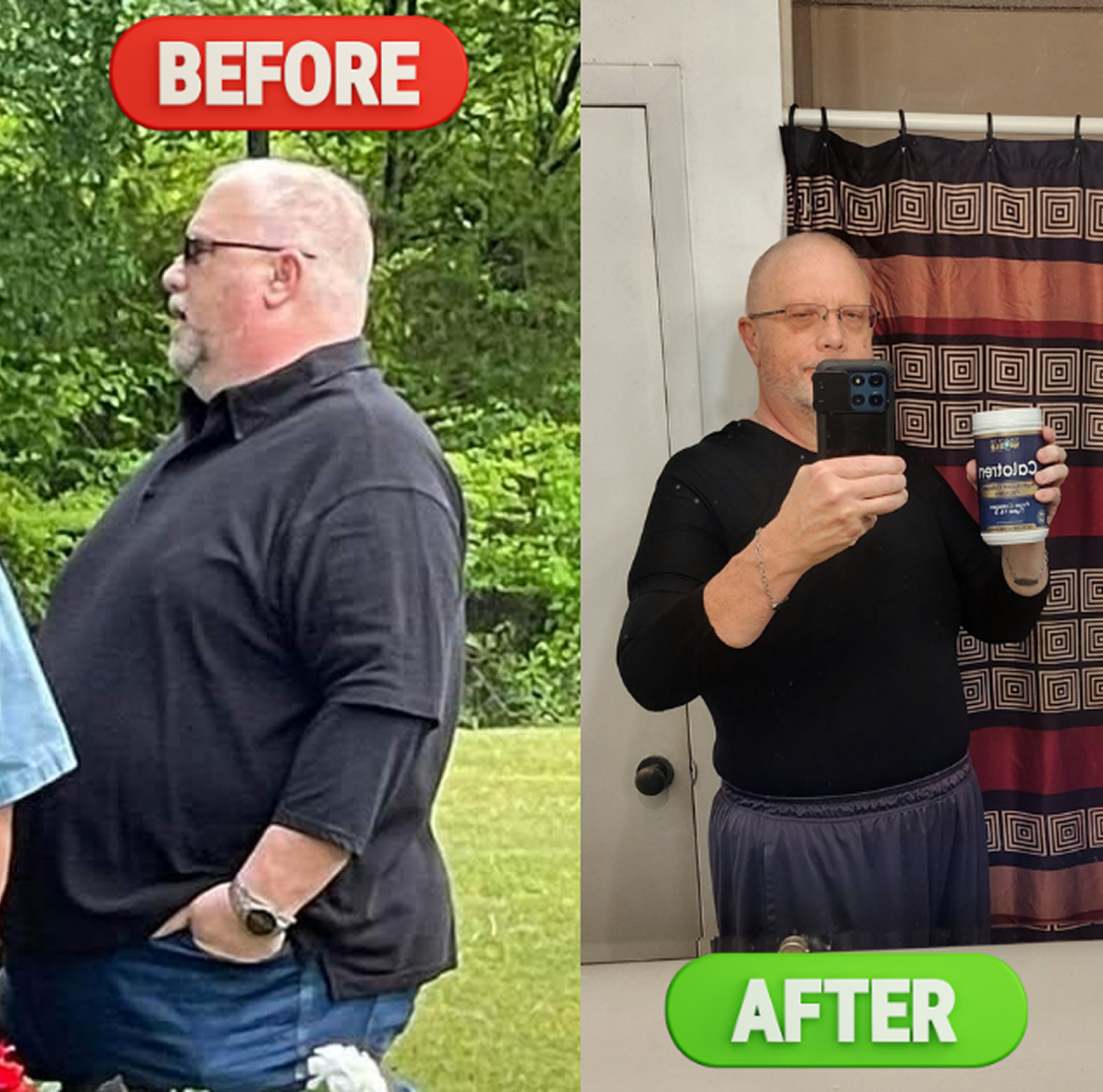 before and after