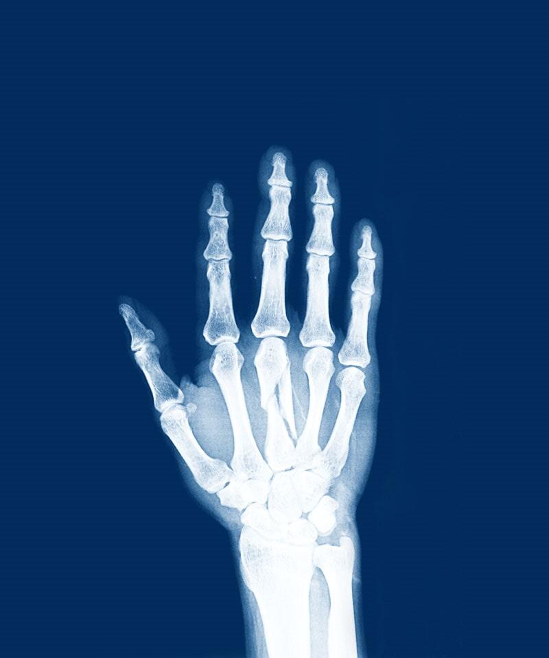 RADIOLOGÍA E IMAGEN