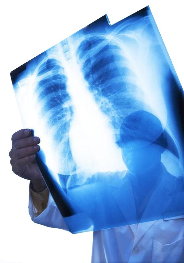 RADIOLOGÍA E IMAGEN
